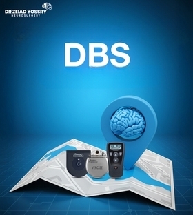 DBS