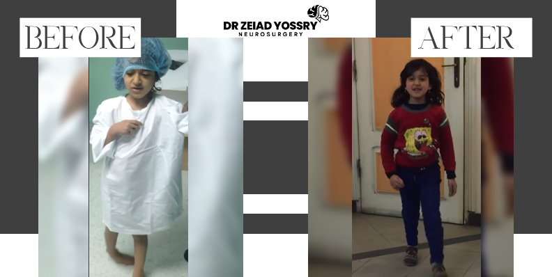 Recovery-of-Little-Aya-from-Genetic-Dystonia-Symptoms